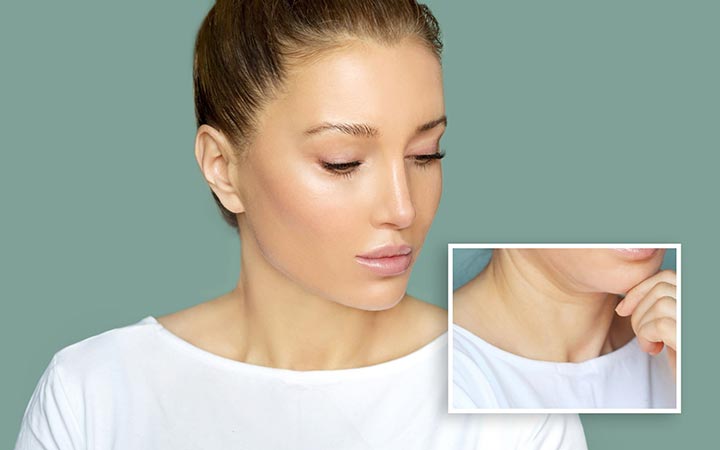Best Non-Surgical Neck Lift Skin Tightening Procedures