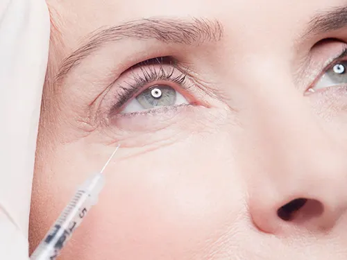 Tear Trough Filler for Under Eye