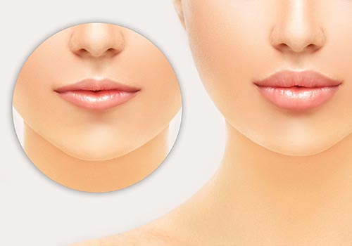 Lip Flip - Aesthetiq Med Spa