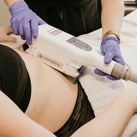 Coolsculpting