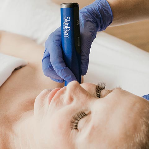 Microneedling